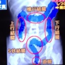 便秘の人や初学者におすすめなIBS（過敏性腸症候群）を治す本